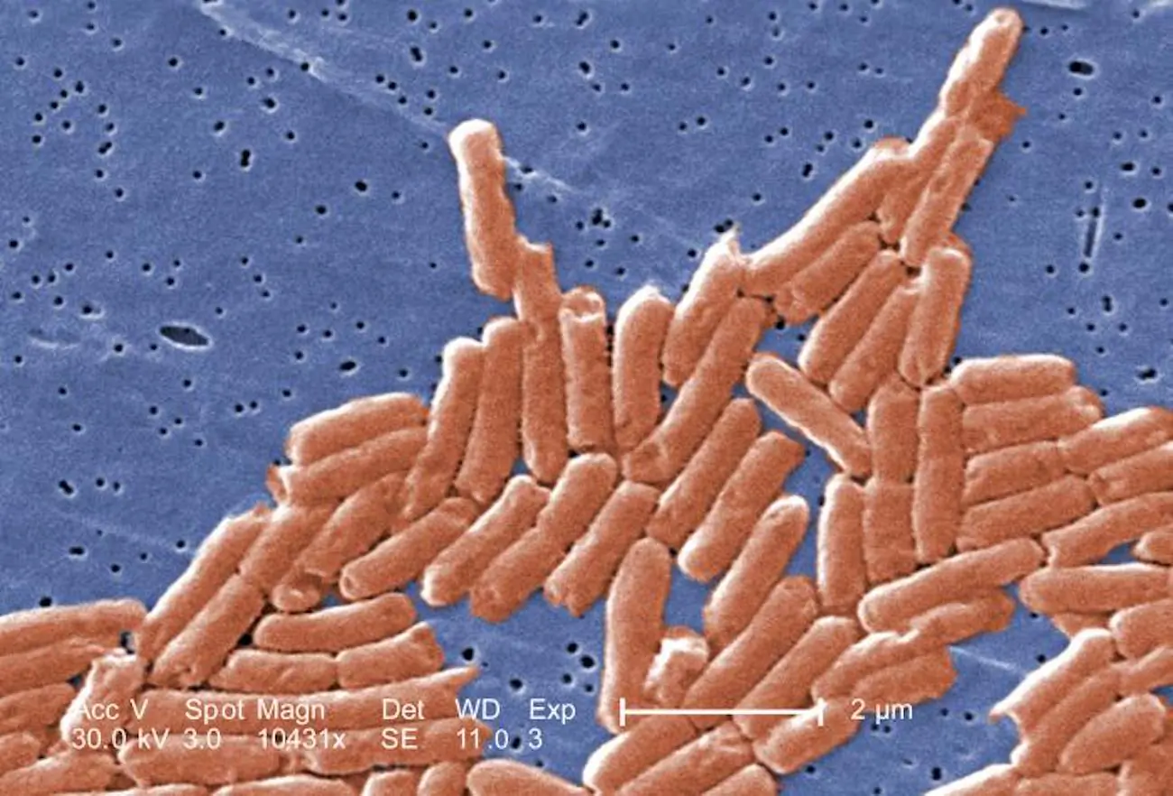 WHO Warns of Widespread Resistance Against Antibiotics Worldwide