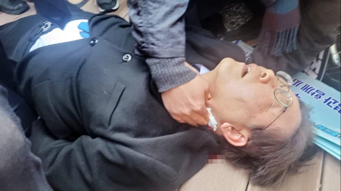 south korea stabbed