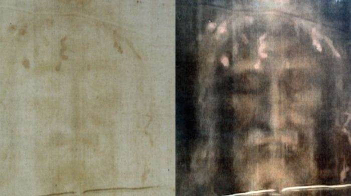 Turin Shroud torture evidence