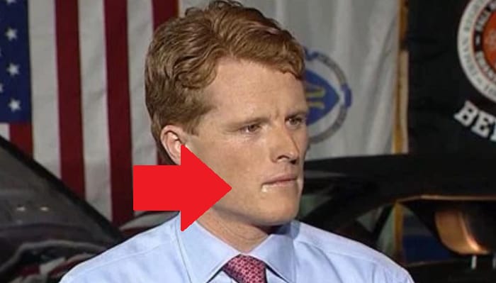 joe kennedy lips