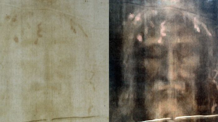 Turin Shroud torture evidence